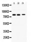 Anti-Synapsin I Picoband Antibody
